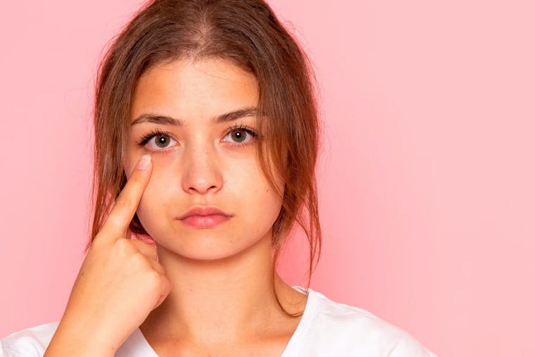 Onze top 7 tips voor het verwijderen van wallen onder de ogen