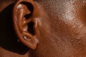 Oljig och kombinerad hud: Så här vårdar du den