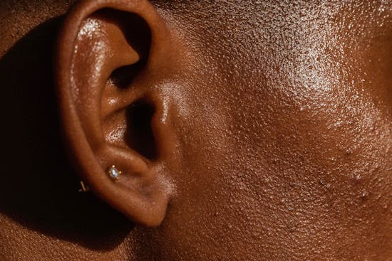 Oljig och kombinerad hud: Så här vårdar du den