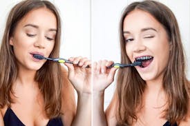 Tandblegning med aktivt kul, virker det?